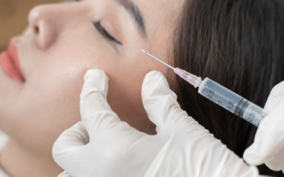 Filler occhiaie: quando è indicato e cosa aspettarsi